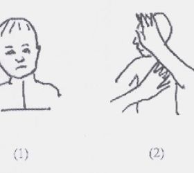 RighTorticollis1.jpg