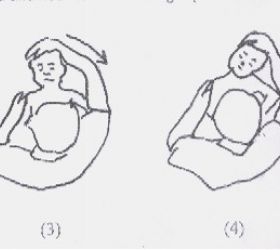 RightTorticollis2.jpg