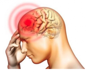 Headache_meningitis.png