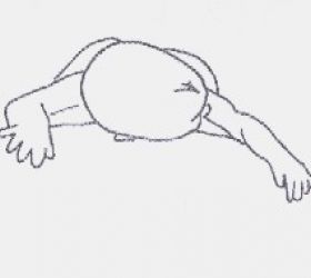 proneTorticollis_1.jpg